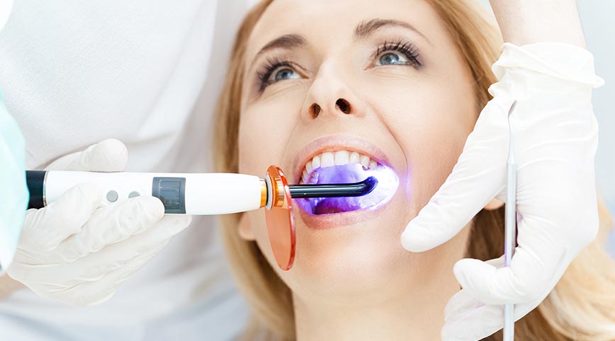 Teeth Whitening Options: From DIY to Professional Treatments